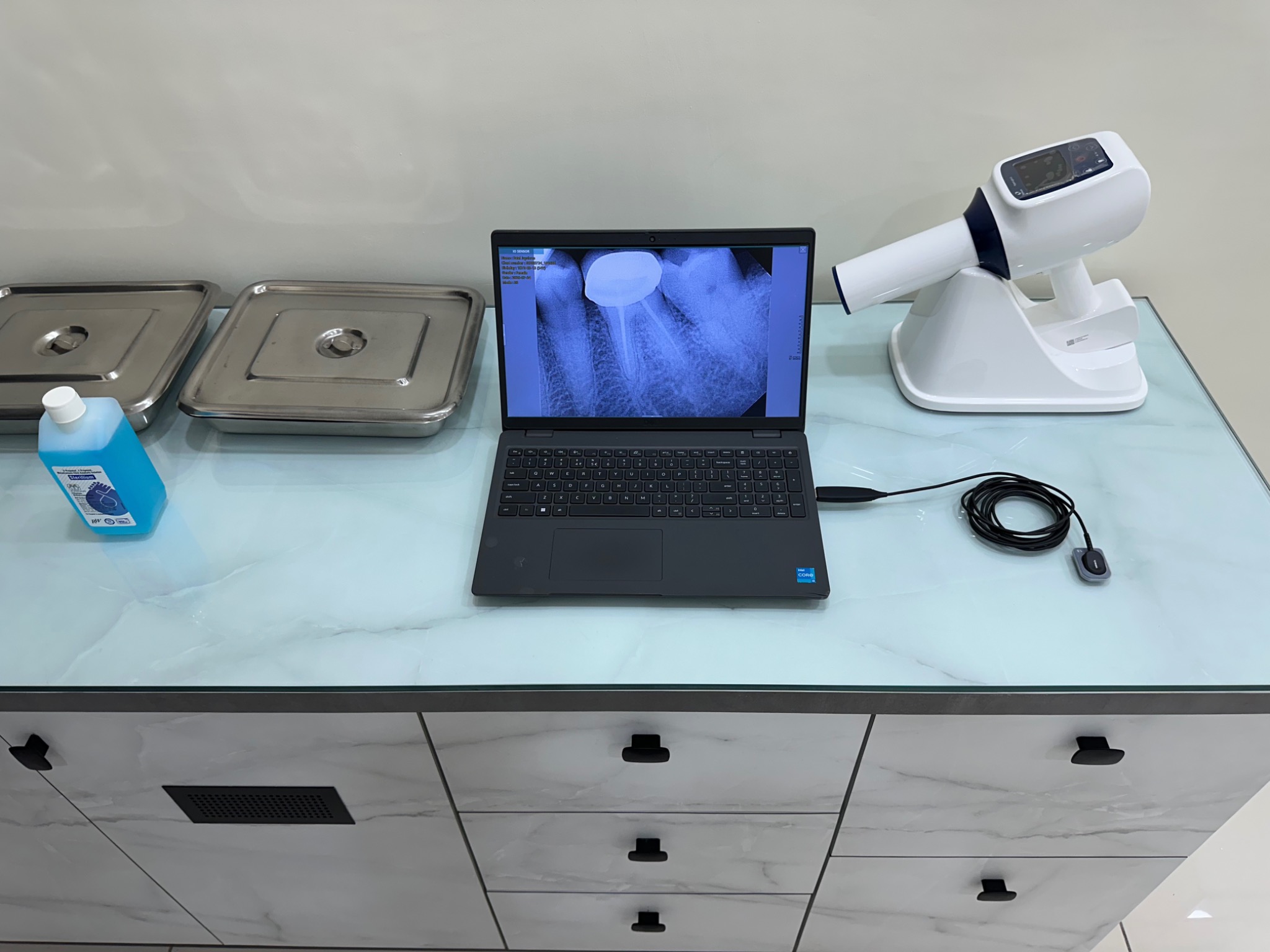 Digital dental X-ray system